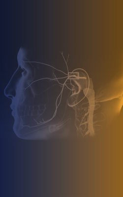 neralgia-do-trigenio