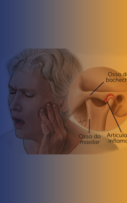 tratamento-da-dtm